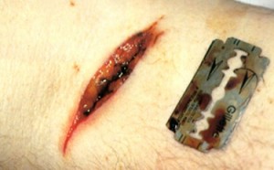 Intentan degollar hombre en vecindario del Alto Manhattan