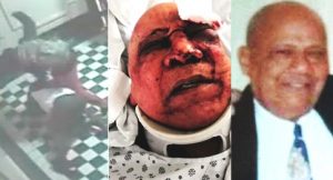 Salvaje paliza a dominicano durante asalto en su edificio