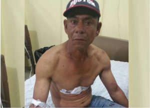 SALCEDO: Siete heridos durante atraco, roban 700 mil pesos y una camioneta