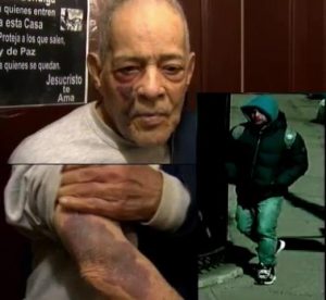 Extraño propina brutal paliza a un abuelo dominicano en El Bronx Extraño propina brutal paliza a un abuelo dominicano en El Bronx