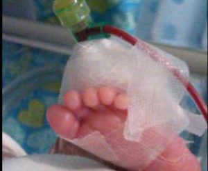 Tribunal autoriza transfusión de sangre a hija de testigos Jehová