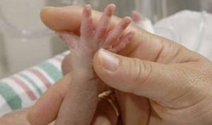 RD ocupa el quinto lugar entre 51 países con más muertes infantiles