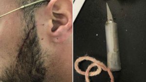 Pandillero le corta la cara a guardia de corrección de Rikers Island