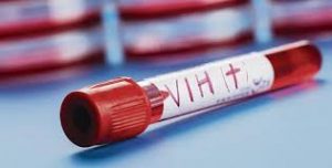 Onusida dice 2.300 personas se infectan cada año con el VIH en RD Onusida dice 2.300 personas se infectan cada año con el VIH en RD