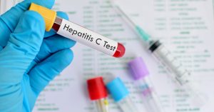 Un nuevo examen acelera el diagnóstico de la Hepatitis C