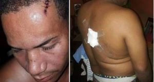 BARAHONA: Pelea entre «danilistas» y «leonelistas» deja dos heridos BARAHONA: Pelea entre «danilistas» y «leonelistas» deja dos heridos