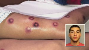 N. YORK: Arrestan hombre disparó rifle «paitball» contra menor dominicano