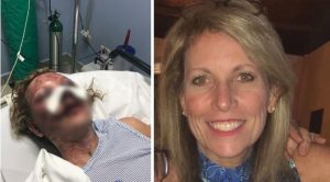 Autoridades R. Dominicana investigan agresión a estadounidense en un hotel