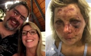 Esposo turista golpeada en Punta Cana acusa de «mentirosas» autoridades RD