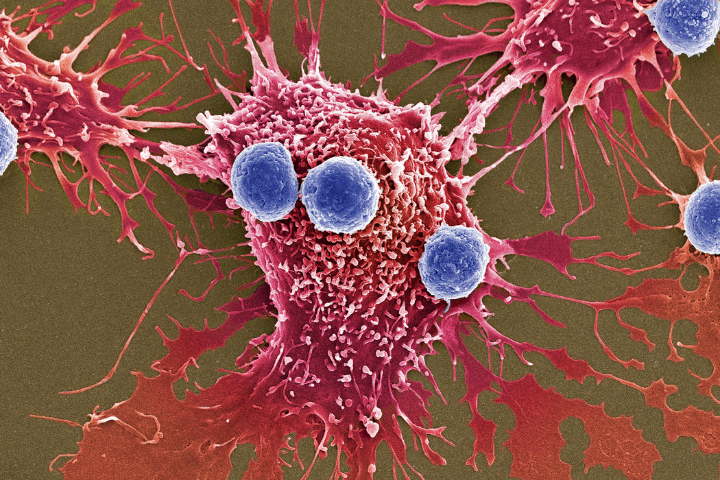 Nuevas armas contra el cáncer: millones de bacterias programadas para matar imagen