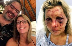 Turista que dice haber sido golpeada en la RD demanda a un hotel de Punta Cana