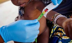 ONU alerta que 22 por ciento de niños en Haità padecen desnutrición ONU alerta que 22 por ciento de niños en Haità padecen desnutrición