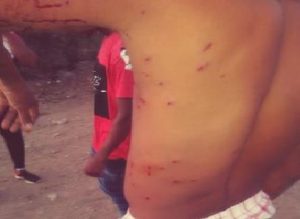 BARAHONA: Varios campesinos heridos en protesta por falta de agua