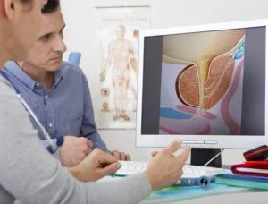 Sugieren aumentar campaña prevención cáncer de próstata