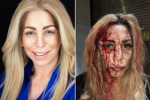 Racistas desfiguran rostro de actriz y modelo latina en bar de Midtown