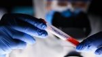 ¿Qué se sabe sobre la mutación del SARS-CoV-2?