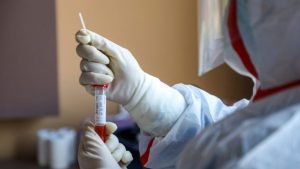 En la RD han sido realizadas 56,710 pruebas coronavirus, dice Ministro