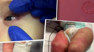 Mueren tres niños en Nueva York por síndrome ligado al coronavirus