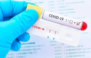 Identifican 319 personas con síntomas del coronavirus en Santiago Oeste