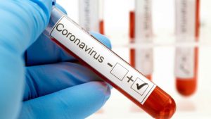 MSP dice siguen en descenso casos de coronavirus en la Rep. Dominicana