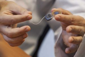 Otorrinos del Gautier buscan devolver la audición a sordos con trasplantes