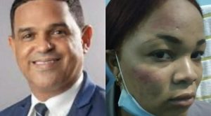 SCJ designa jueza para conocer acusación contra diputado Duarte