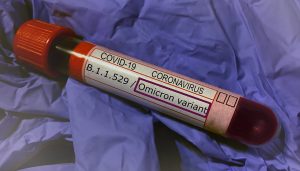 Infectología advierte se podrían incrementar casos ómicron en RD