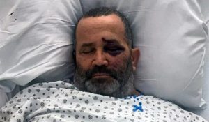 NY: Taxista dominicano de 61 años sufre asalto y golpiza en El Bronx