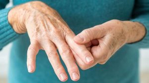 Consejos especializados para manejar la artritis reumatoide