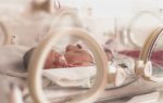 Ocho de cada 100 bebés en la Rep. Dominicana son prematuros