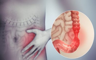 Tengo síndrome de colon irritable o enfermedad inflamatoria (EII)? Tengo síndrome de colon irritable o enfermedad inflamatoria (EII)?