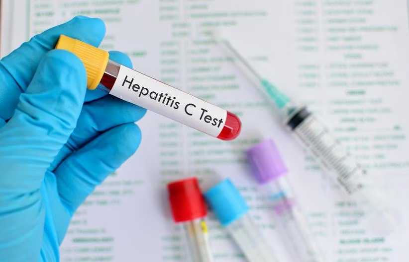 Hepatitis, más letal que la malaria, la tuberculosis y el sida imagen