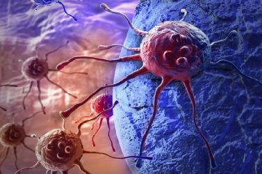 Activan comisión crear centro de tratamiento cáncer en Haití Activan comisión crear centro de tratamiento cáncer en Haití