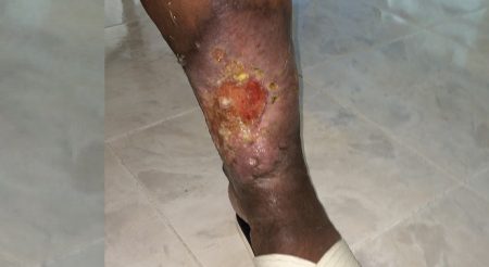 La Romana y SF Macorís tendrán centros para dolencias vasculares La Romana y SF Macorís tendrán centros para dolencias vasculares