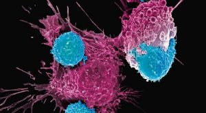 Inmunoterapia CAR-T ataca cáncer ovario en ratones con una dosis