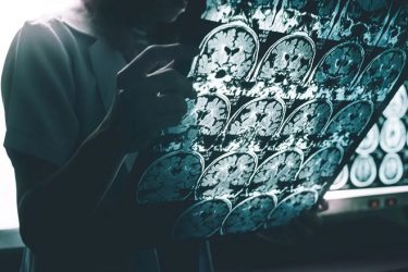 Hallan una posible relación entre el estrés crónico y el Alzheimer Hallan una posible relación entre el estrés crónico y el Alzheimer