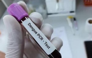 Prueba de PCR agiliza diagnóstico del dengue en Rep. Dominicana