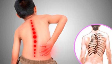 Atrofia Muscular Espinal: segunda causa genética mortalidad infantil