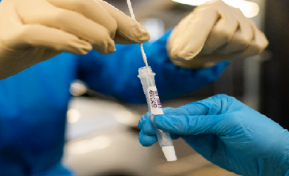 Vigilan en RD comportamiento de la variante JN.1 de Covid-19