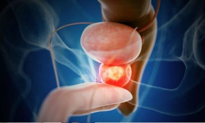 Importancia de la concientización y prevención cáncer de prostata