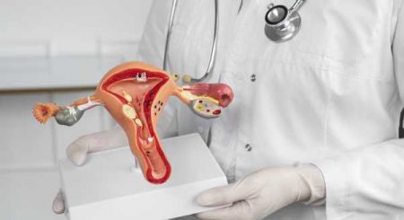 OPS por eliminar el cáncer cervicouterino en América Latina OPS por eliminar el cáncer cervicouterino en América Latina