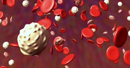 Cada 27 segundos una persona es diagnosticada con cáncer sangre