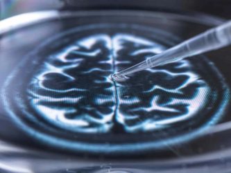 Nuevas huellas genéticas de la discapacidad mental