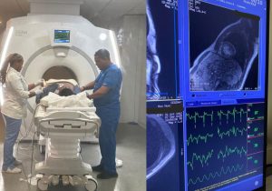 Realizan primera resonancia cardíaca de estrés en la RD