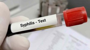 Casos de sífilis en adultos aumentaron en las Américas Casos de sífilis en adultos aumentaron en las Américas