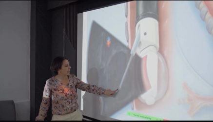 Introducen en RD tecnología para diagnóstico cáncer pulmón