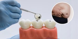 Pérdidas dentales inciden en el aumento de peso, según estudio