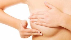 Grupo Médico realizó jornada gratis prevención cáncer mama Grupo Médico realizó jornada gratis prevención cáncer mama
