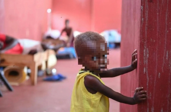 Alerta ONU: Más 250.000 niños en riesgo desnutrición aguda